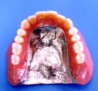 金属床(チタン)